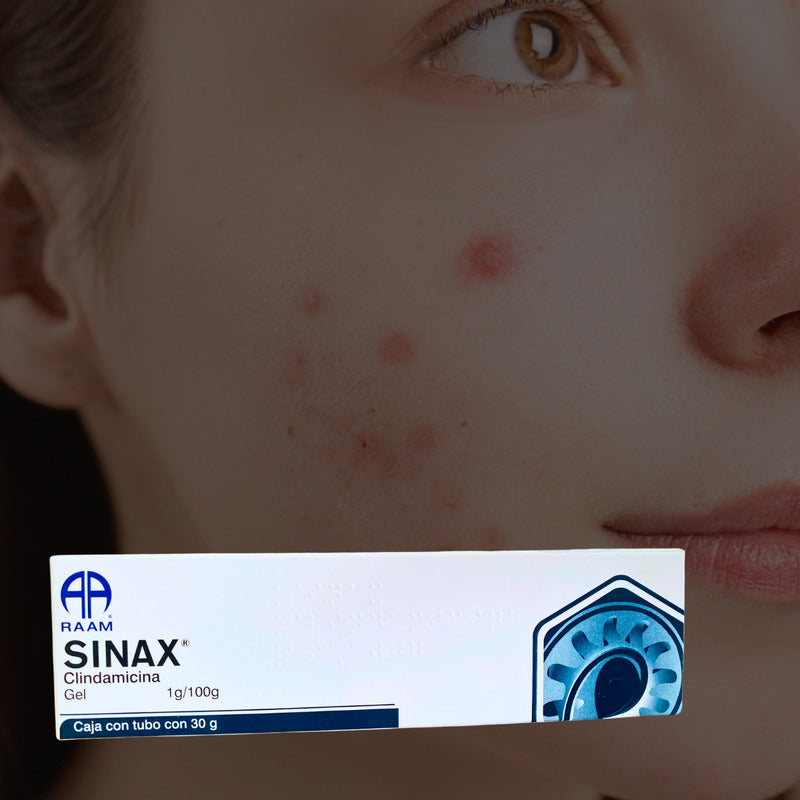 Sinax Clindamicina Gel 1g / 100g Tubo Con 30 G Raam
