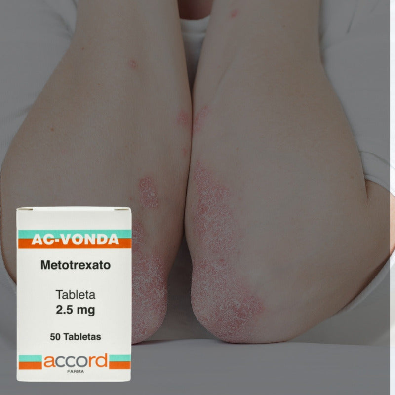 Ac-vonda Metotrexato 2.5 Mg 2 Frascos 50 Tabletas C/u Accord